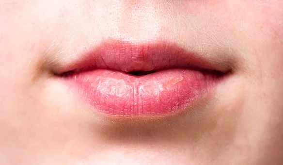 Read more about the article CUIDA TUS LABIOS